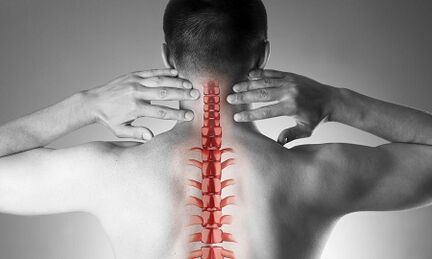 Bizkarrezurreko bizkarrezurraren osteochondrosak nola manifestatzen du