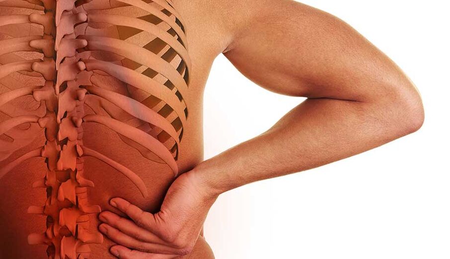 Lumbar bizkarrezurraren osteokondrosia