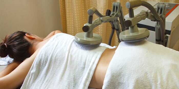bizkarreko minaren fisioterapia tratamendua